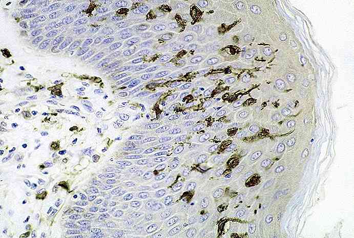 Tipuri de celule dendritice, funcții și histologie