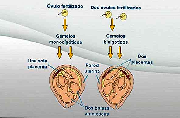 Définition, types et caractéristiques des jumeaux univitelinos