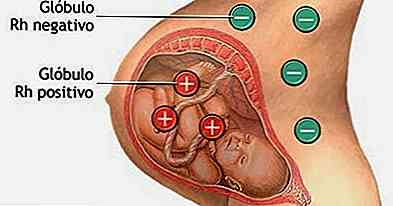 Iso-immunisation maternelle foetale Physiopathologie, Complications, Traitement