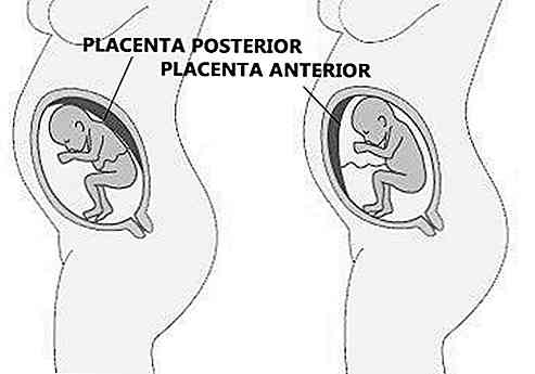 Posteriore Placenta Possibili conseguenze e prevenzione