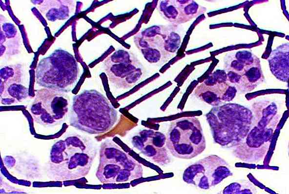 Bacillus anthracis Taxonomie, Merkmale, Krankheiten